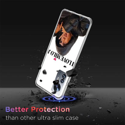 Singer M-Milo J Phone Case For Xiaomi Mi 14 14T 15 15T Poco F7 Ultra M8 M7 M6 M4 M3 X7 X6 X4 Pro M5S 12T 10T Pro 12S 12 11 Lite